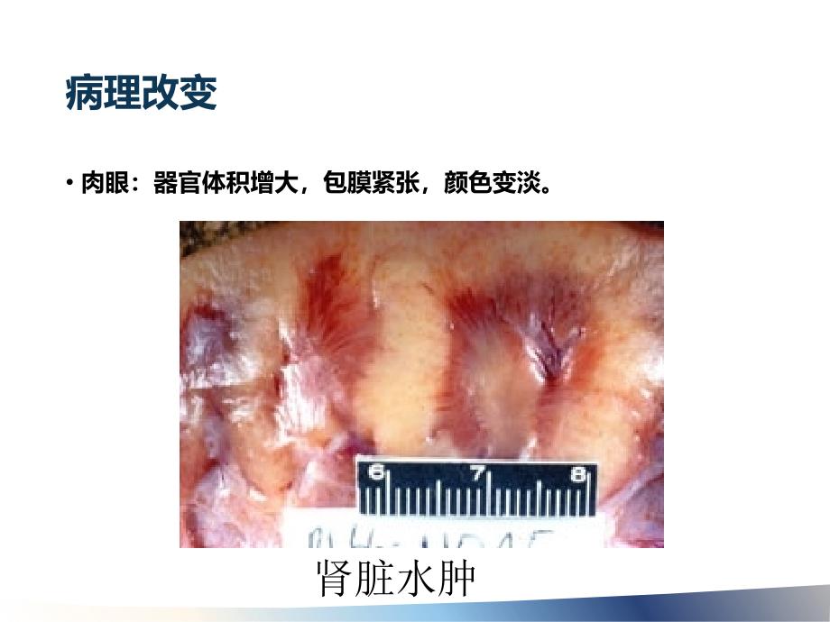 病理2损伤的形式与形态学变化精选文档_第4页