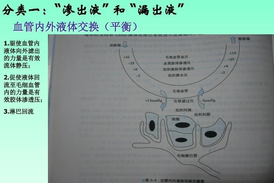 腹水的诊断以鉴别诊断总结_第5页