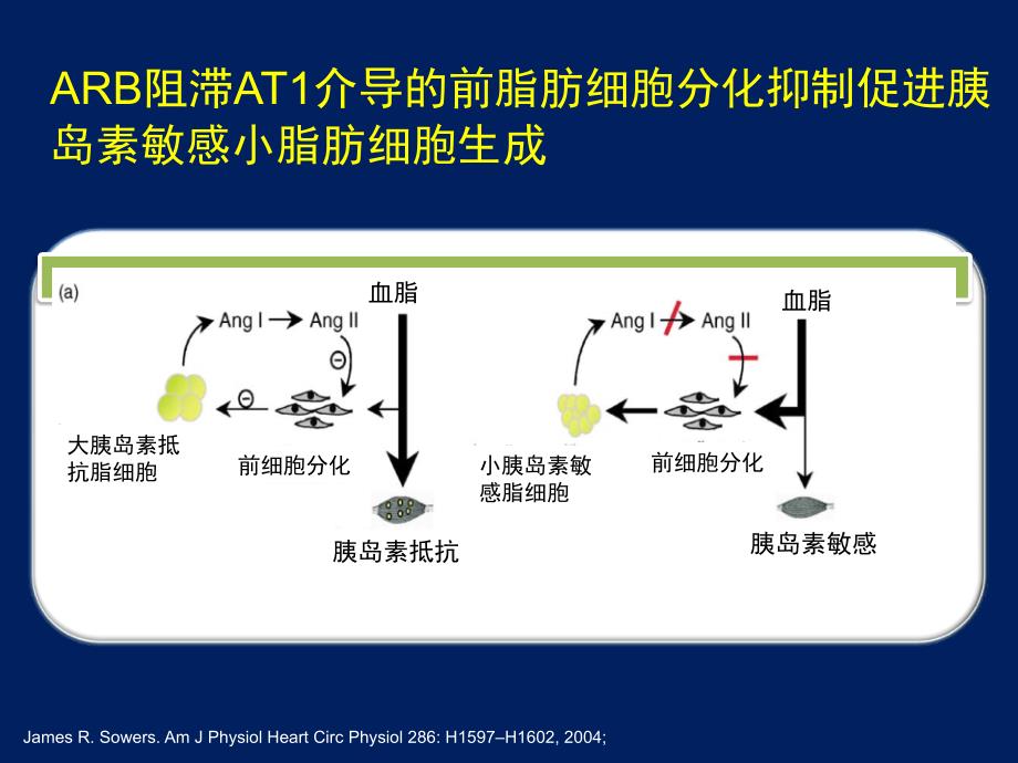 ARB降低新发糖尿病的作用机制_第3页