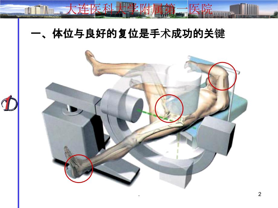 Intertan的手术技巧_第2页