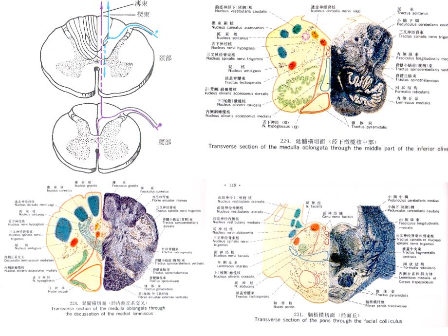 医学课件：神经系统传导通路li_第4页