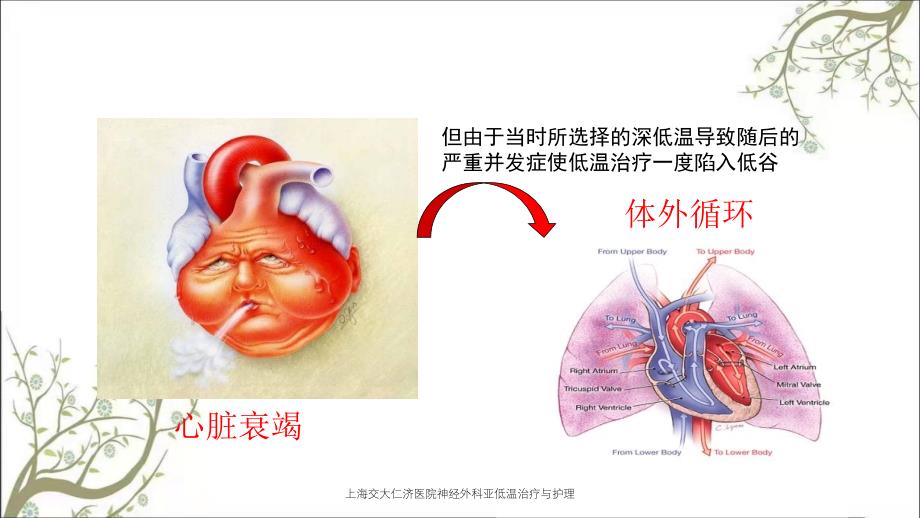 上海交大仁济医院神经外科亚低温治疗与护理_第4页