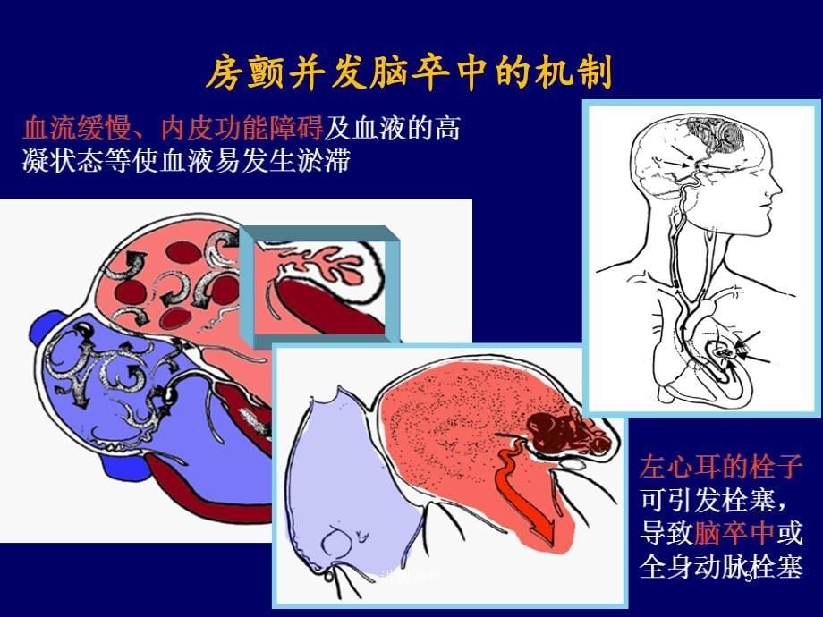 房颤抗凝治疗药物再认识【专业研究】_第5页