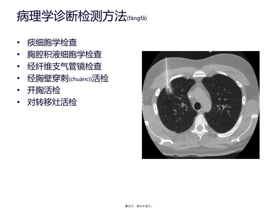 肺癌患者围术期处理新进展课件_第3页