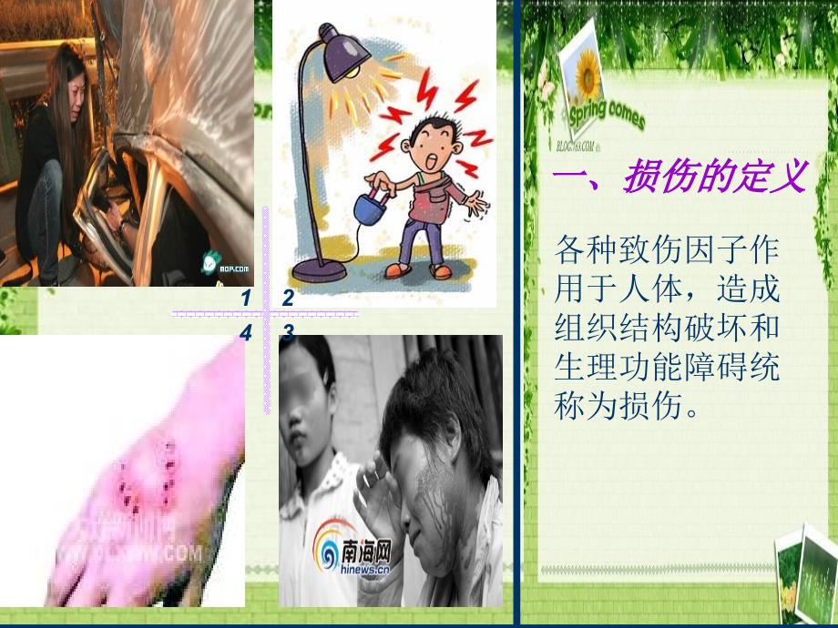 损伤病人的护理ppt课件.ppt_第4页