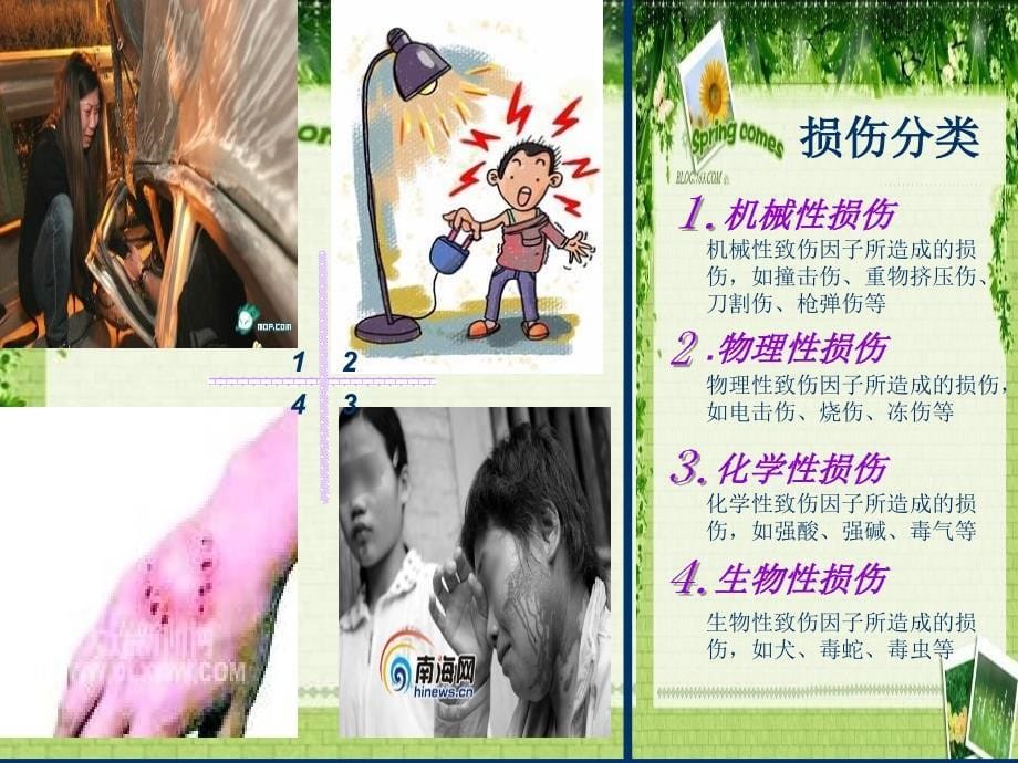 损伤病人的护理ppt课件.ppt_第5页