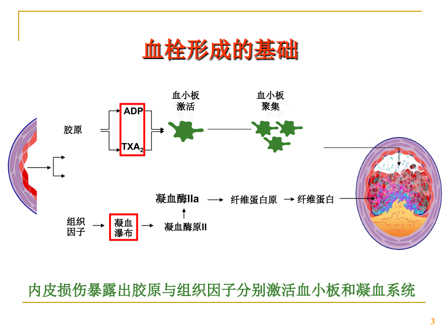 介入治疗的抗栓策略_第3页