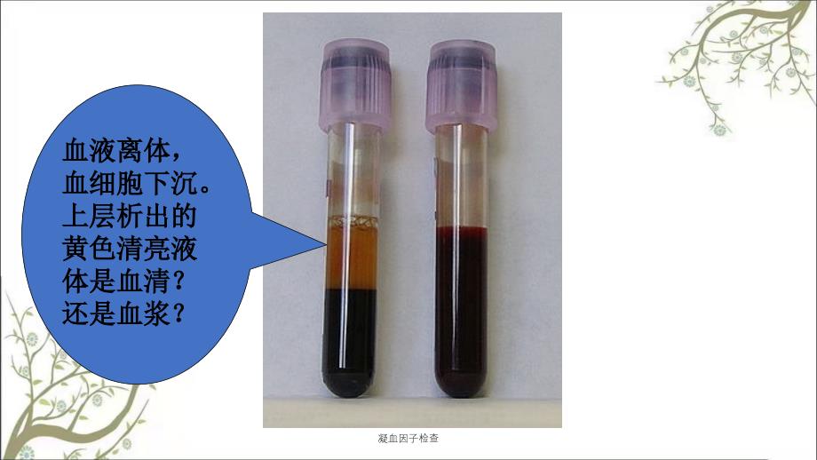 凝血因子检查课件_第4页