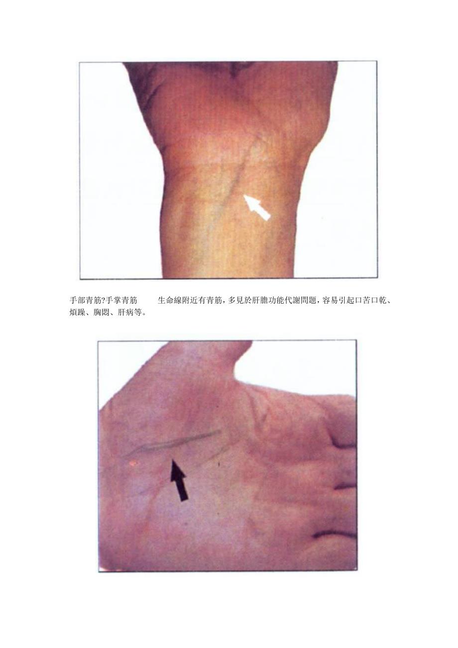 观青筋知健康_第4页