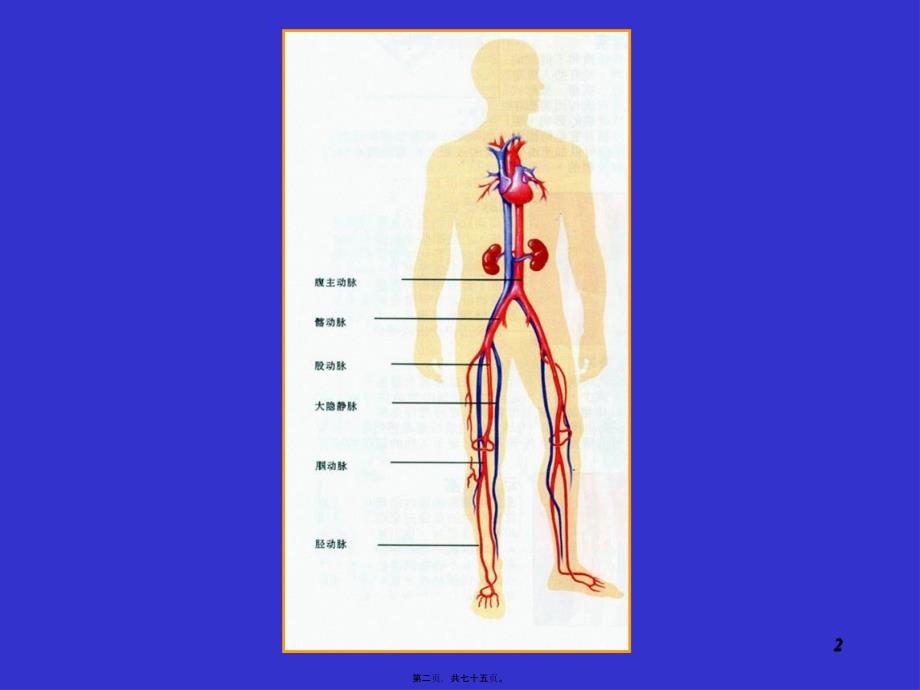 医学专题—周围血管病_第2页