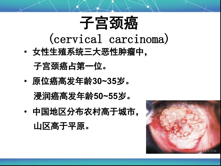 子宫颈癌的临床分期_第2页