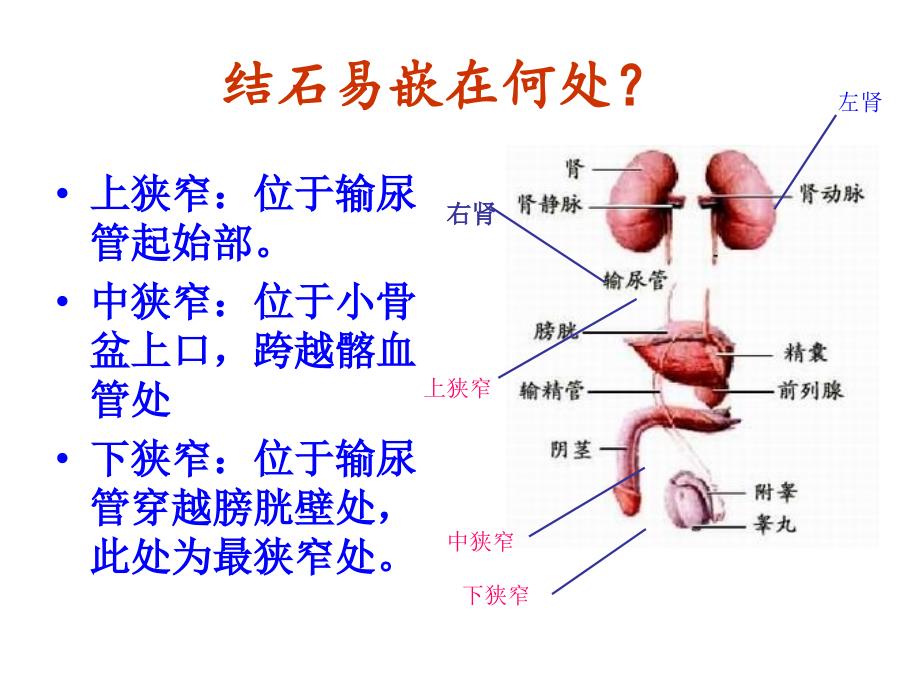 肾输尿管结石()_第2页