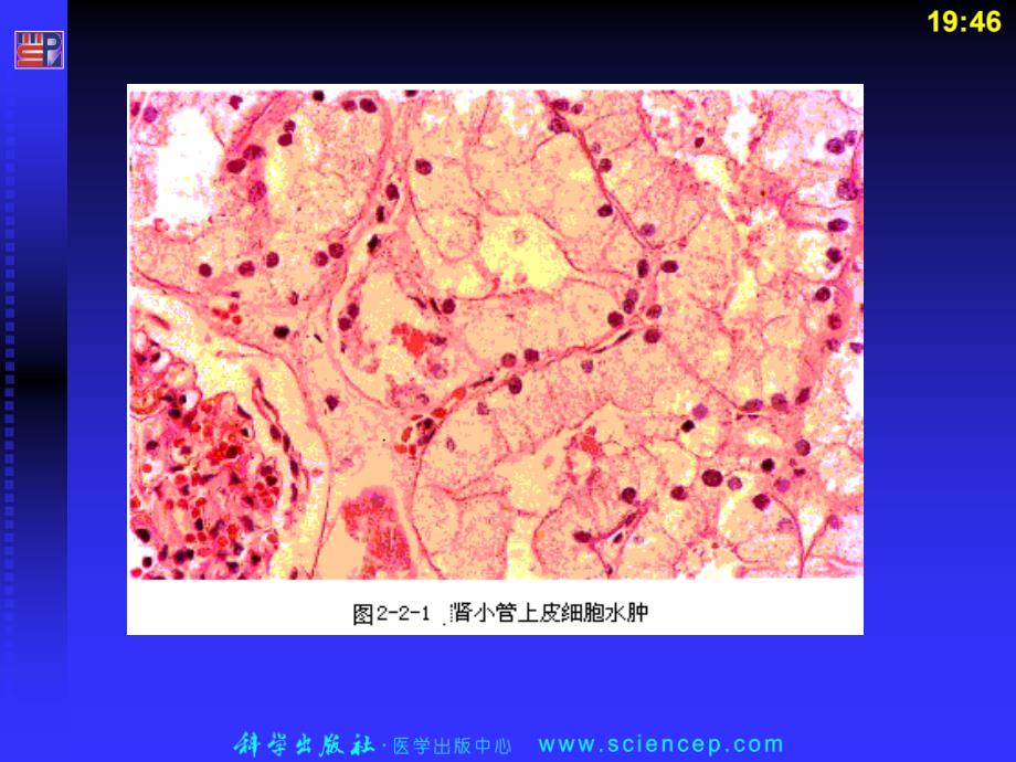 病理学基础病理组织图谱_第3页