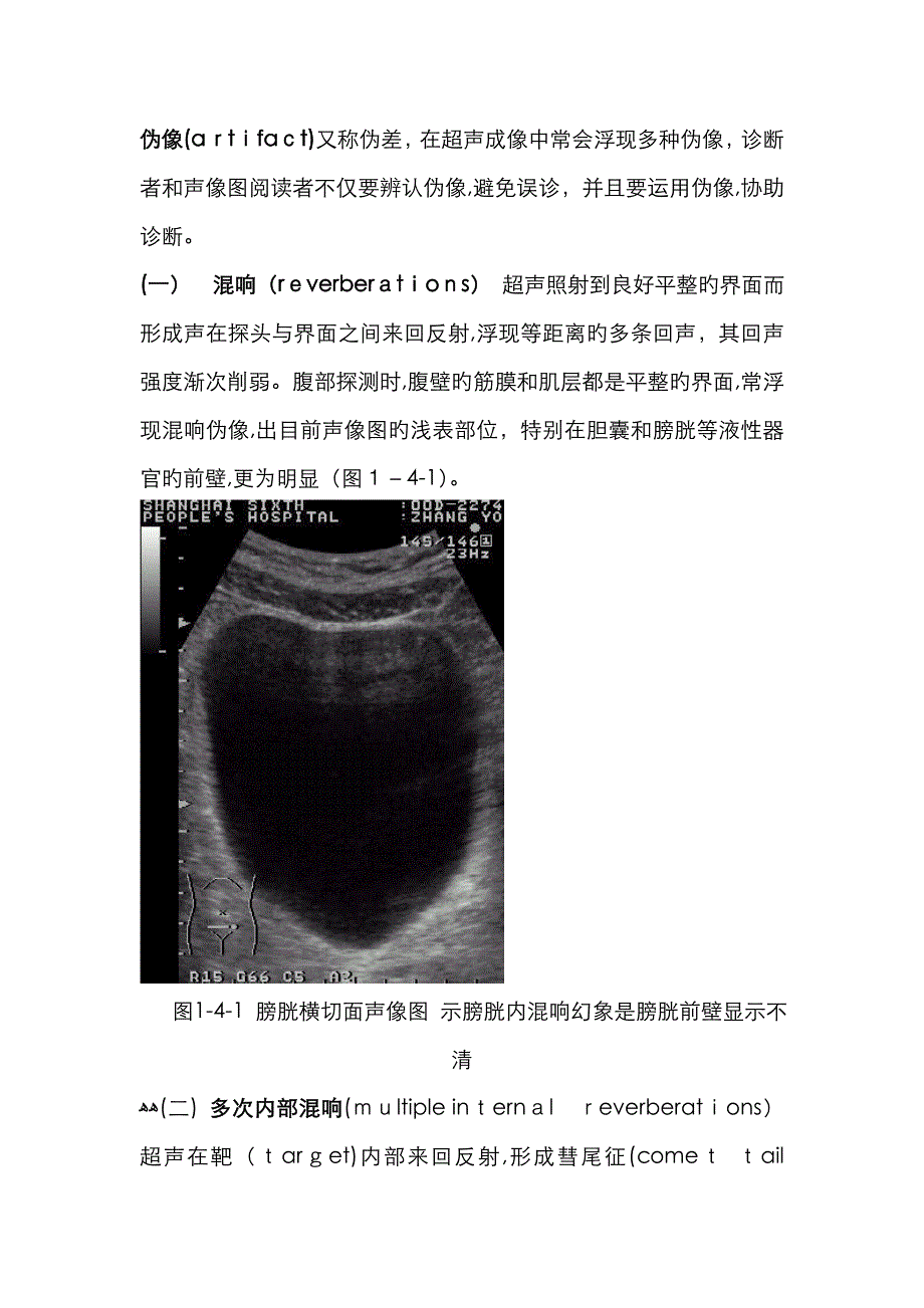 超声伪像_第1页