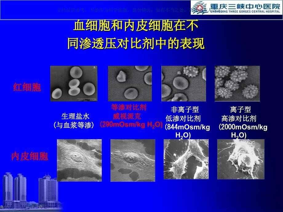 CT对比剂不良反应预防和处置课件_第5页