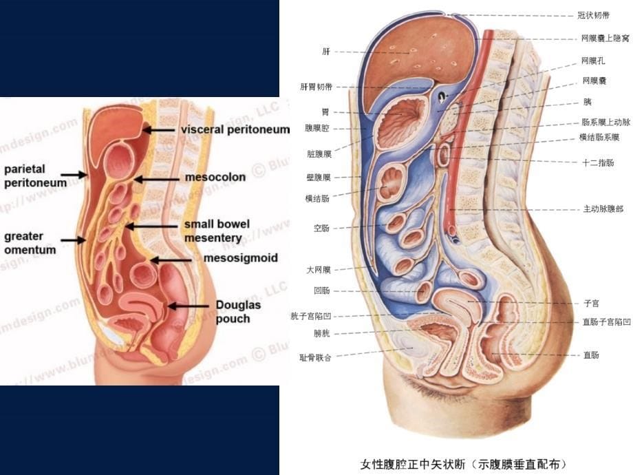 医学PPT课件腹膜病变的CT表现_第5页