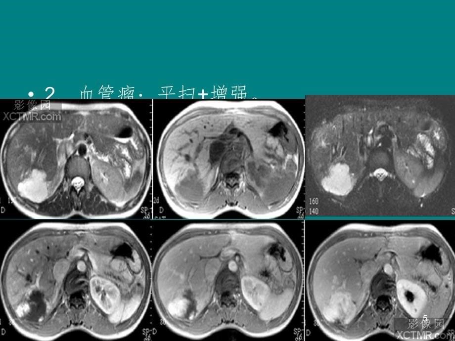 MRI适应症及检查部位PPT演示课件_第5页