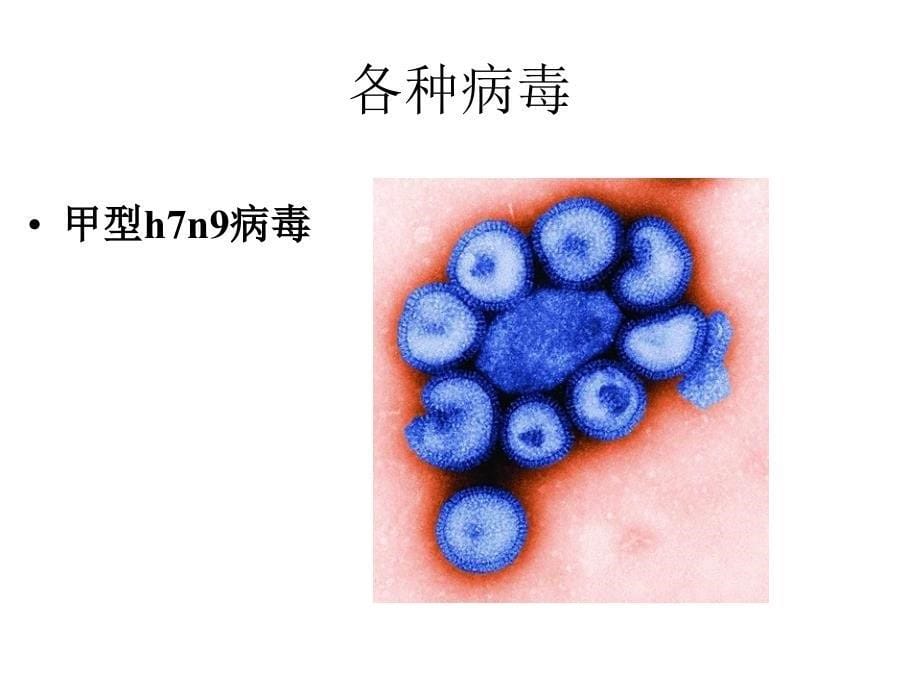 小学科学《病毒》课件_第5页