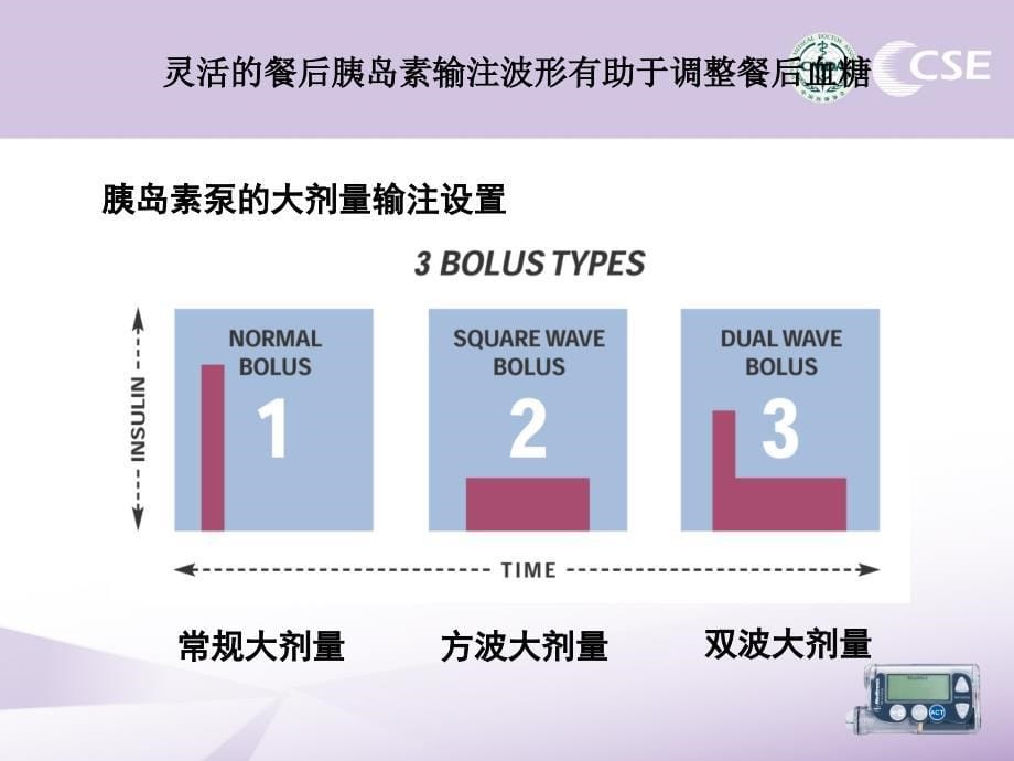 胰岛素泵指南-需更新课件_第5页