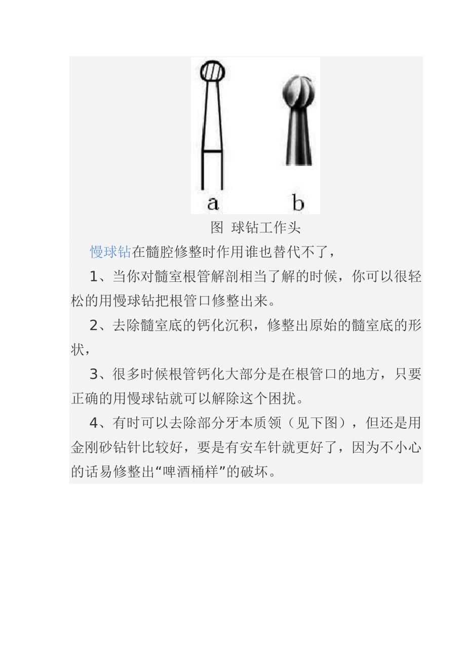 根管治疗器械的选择_第4页