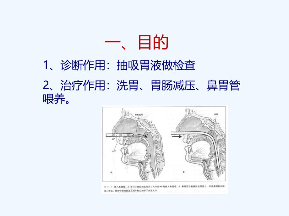 小儿胃管置入术_第3页