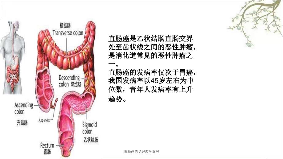 直肠癌的护理教学查房_第3页