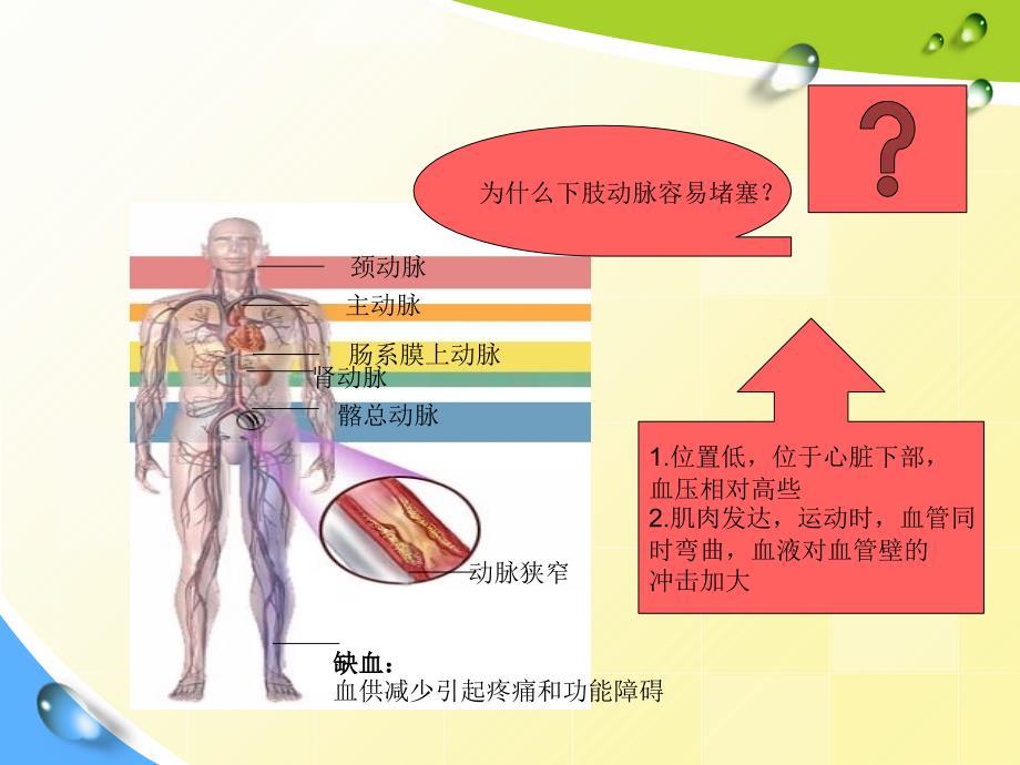 动脉疾病护理PPT课件_第4页