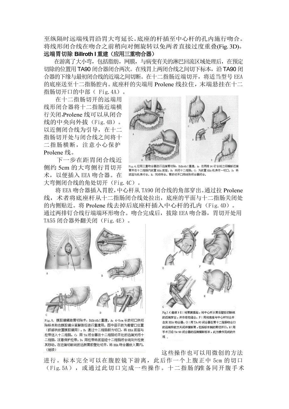 精通外科—普外部分12缝合器技术在胃肠道手术中的应用.doc_第5页