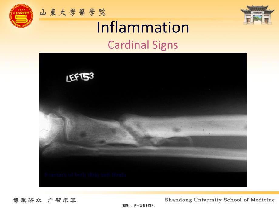 医学专题—炎症-LZY31294_第4页