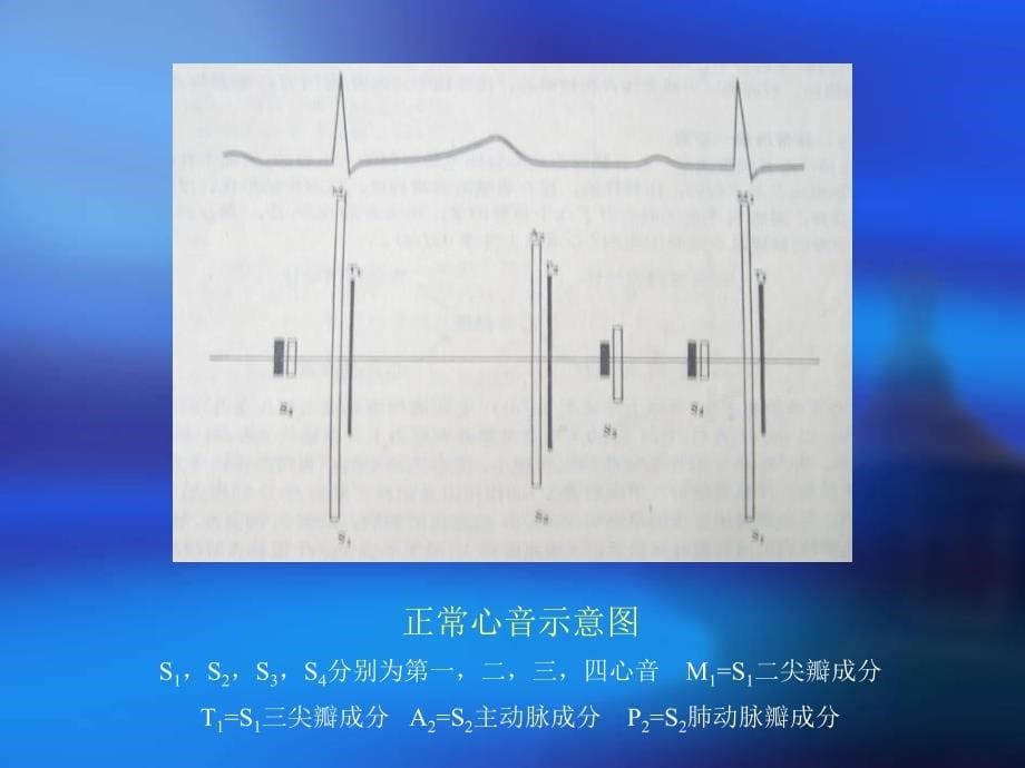 最新心脏听诊中南大学湘雅二医院PPT文档_第5页