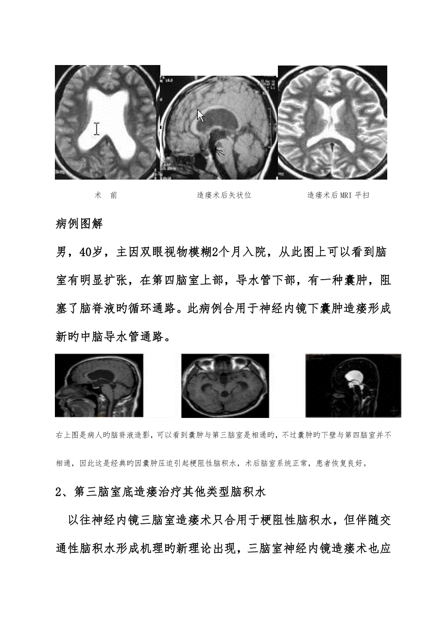 神经内镜发展及未来_第4页