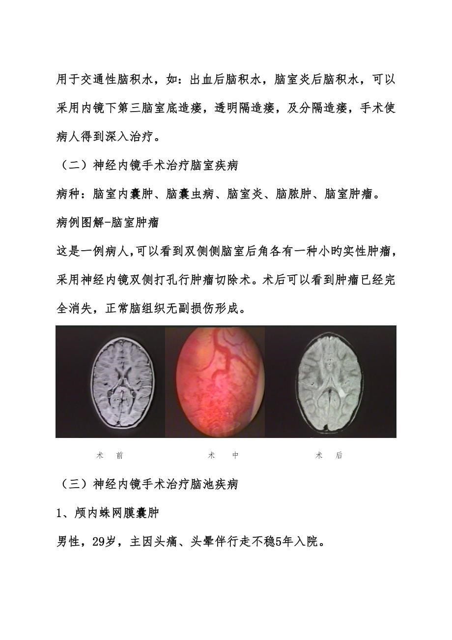 神经内镜发展及未来_第5页