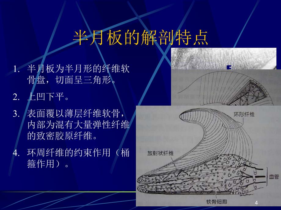 半月板损伤PPT课件_第4页