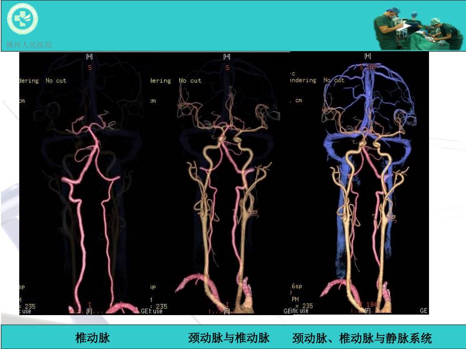 脑动脉解剖与CT重建D_第3页