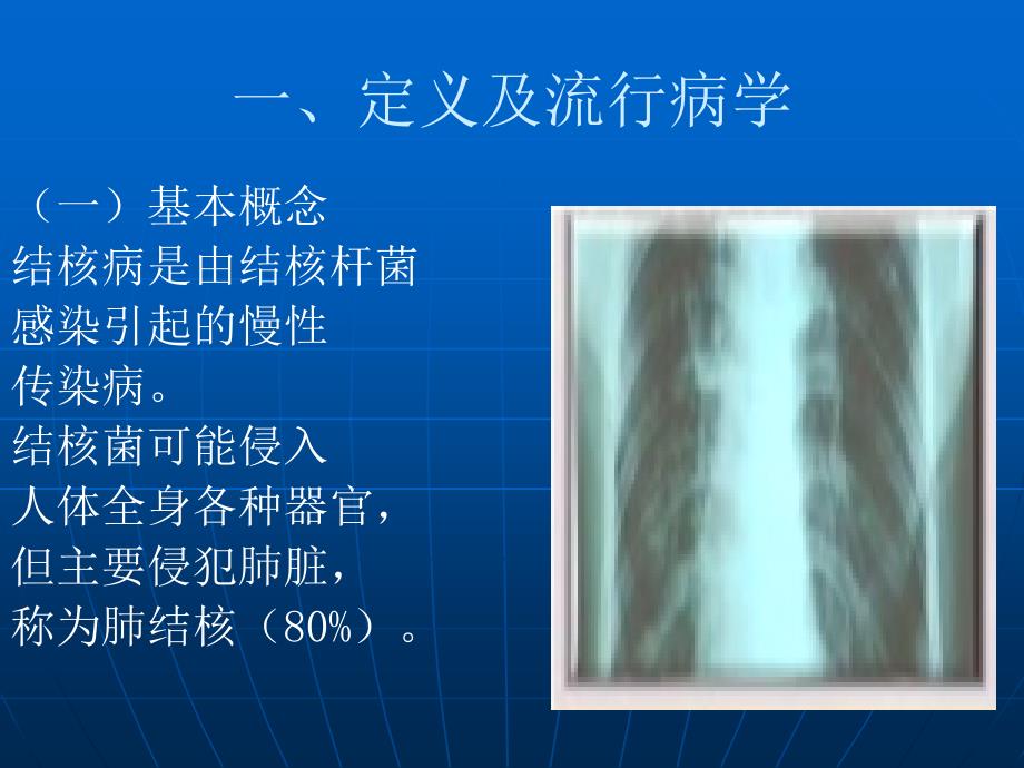 肺结核防治知识_第3页