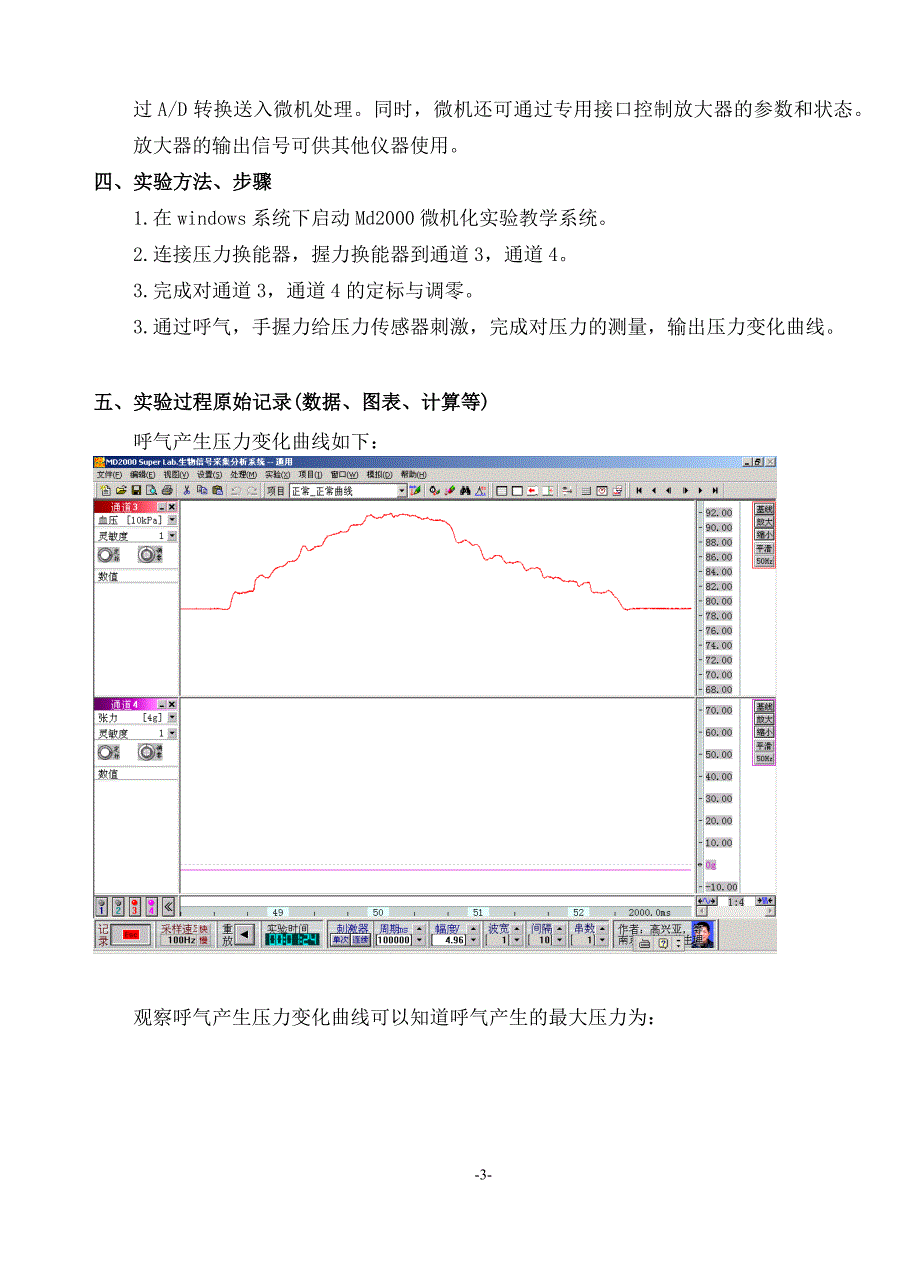 生医系实验室医用压力传感器实验报告_第3页