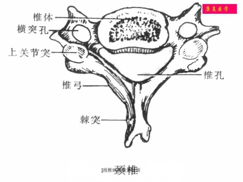 颈椎病的康复范文课件_第5页