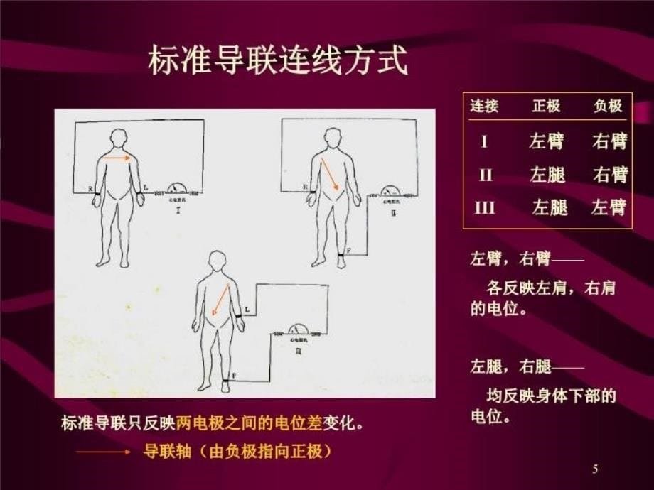 最新心电图心电向量与心肌缺血PPT课件_第5页