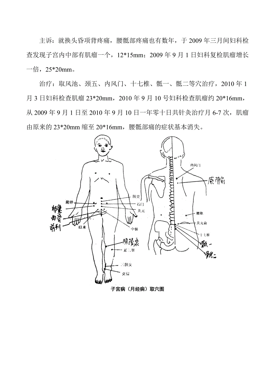 调控针灸学续篇之子宫病与附件病.doc_第3页