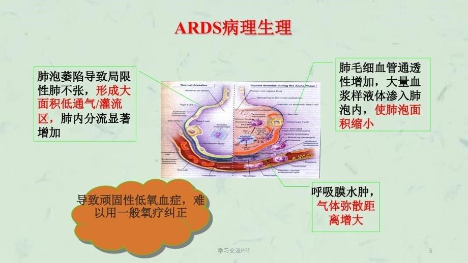 ARDS护理ppt课件_第5页