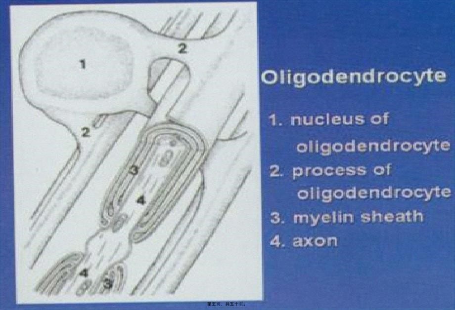 中枢神经系统脱髓壳病(详细)课件_第5页