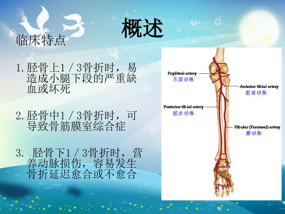 胫腓骨骨折ppt课件_第3页