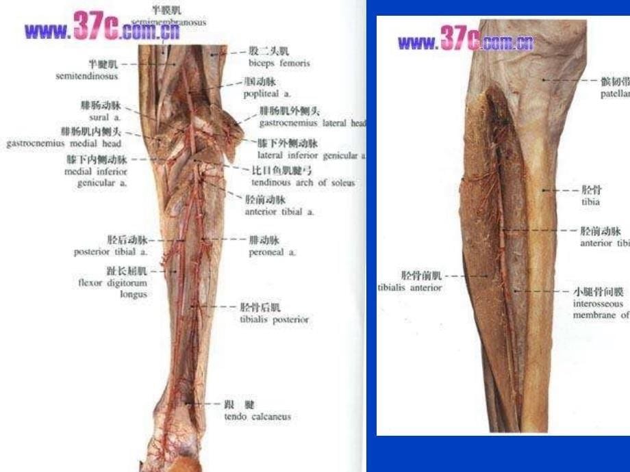 最新：CDFI在下肢血管血栓性疾病诊断中的应用课件文档资料_第5页