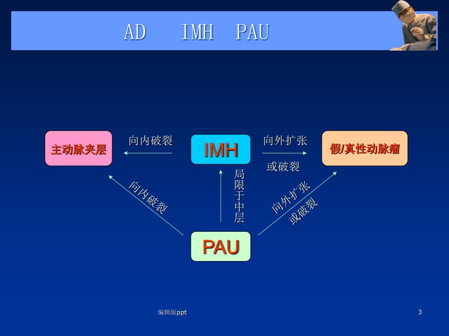 主动脉夹层壁间血肿及穿通性溃疡课件_第3页