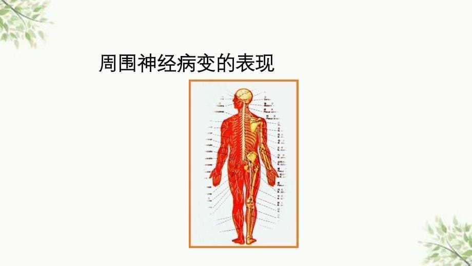 关注糖尿病神经病变ppt课件_第5页