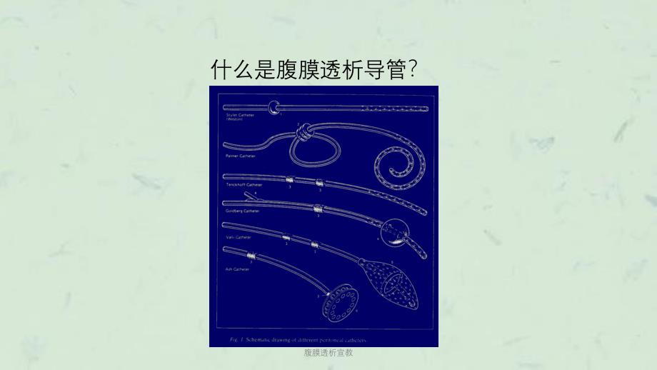 腹膜透析宣教课件_第2页