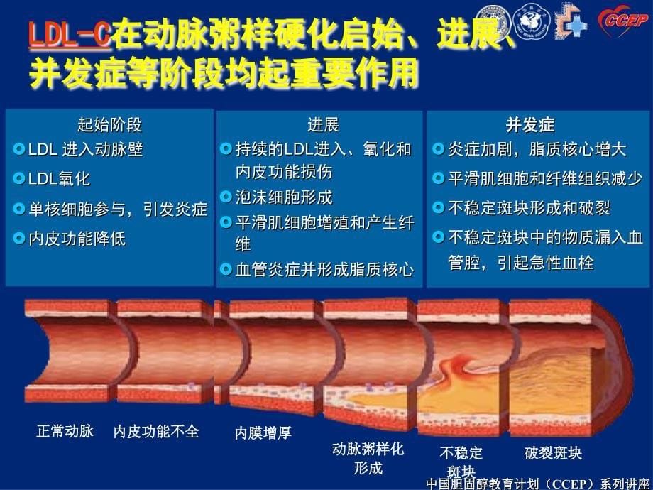 他汀抗动脉粥样硬化治疗的基石_第5页