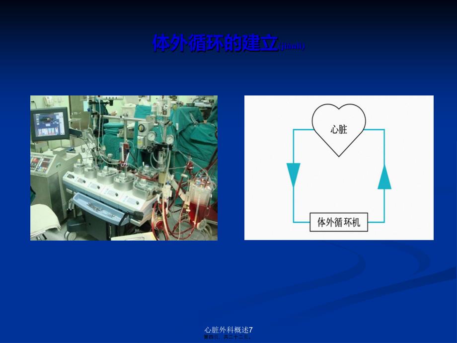 心脏外科概述7课件_第4页