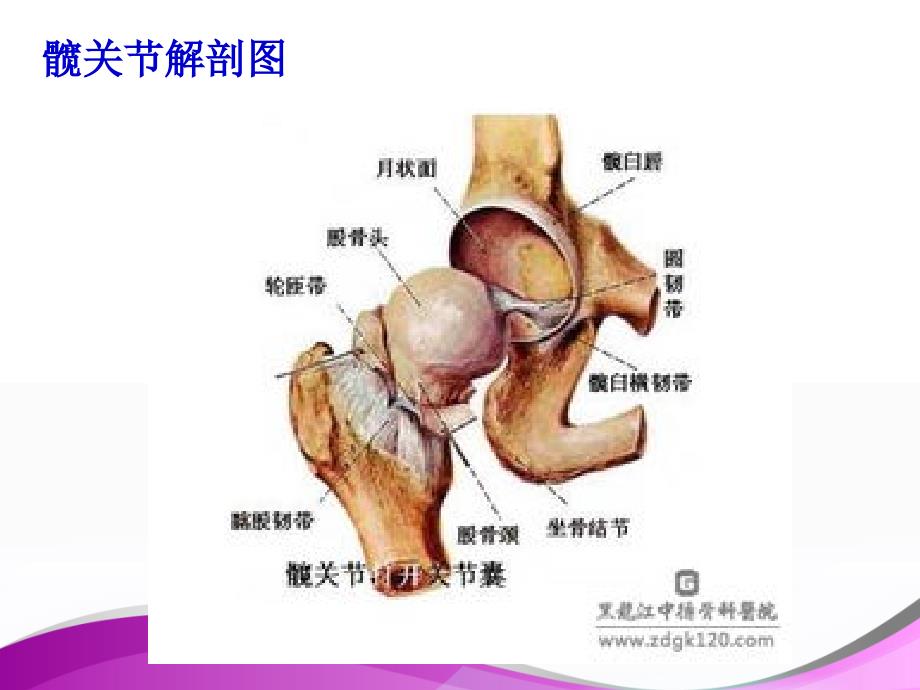 全髋关节置换术后围手术期的护理(新).ppt_第3页