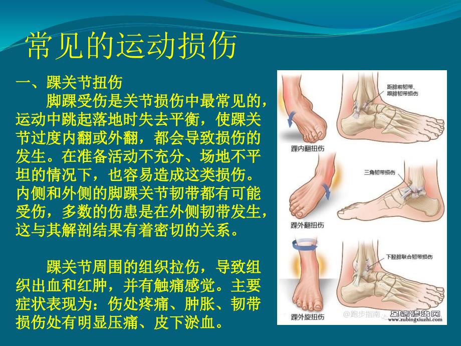 hw----常见损伤的应急处理与急救ppt解析_第2页